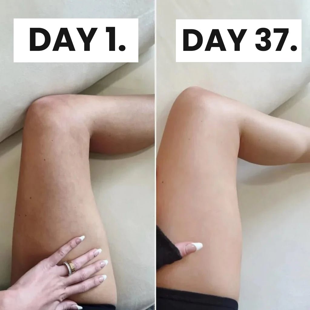 CurveRevive™ Cellulite Relief Kit