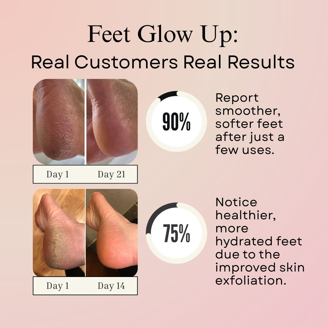 Amore De Sole Electric Foot Callus Remover